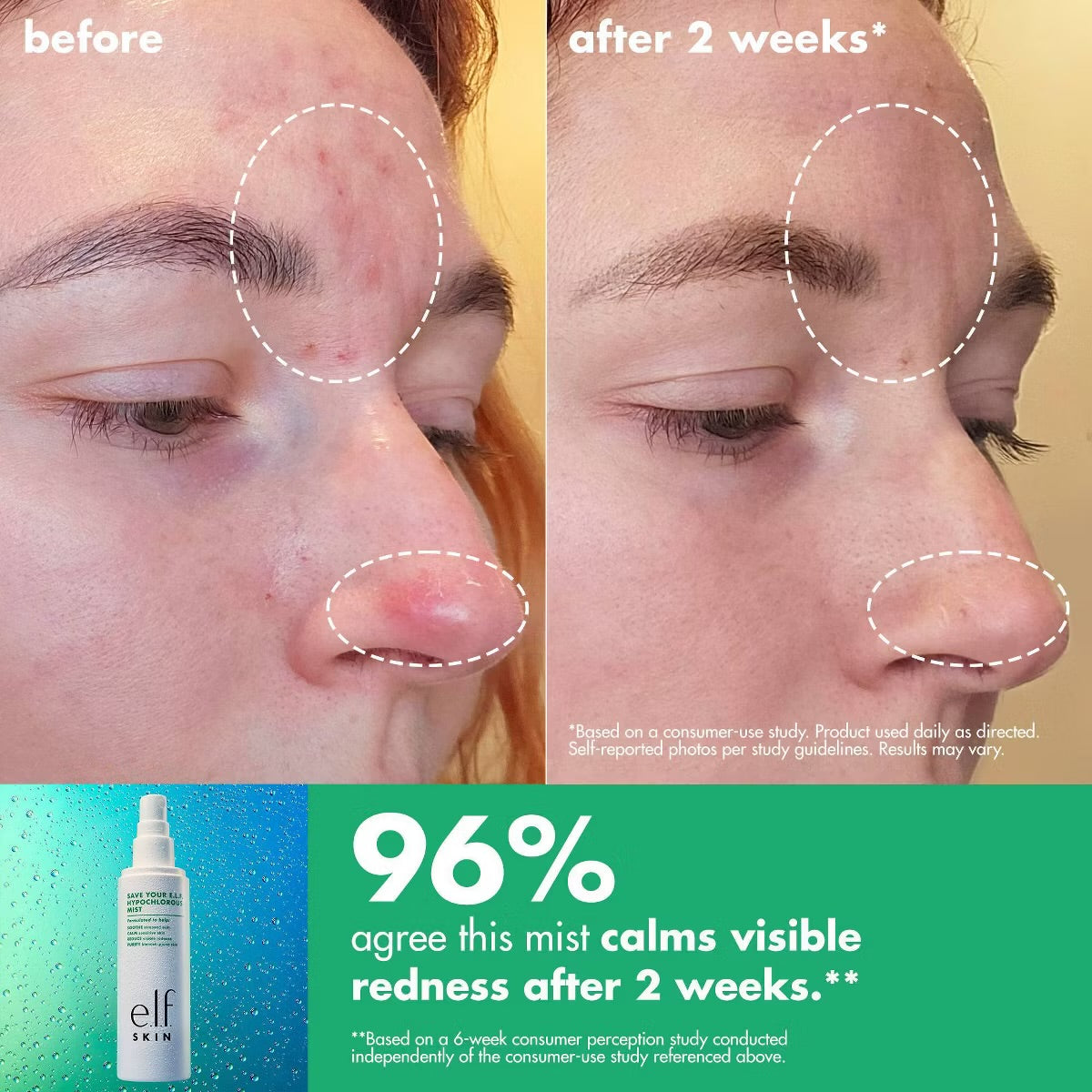 Elf Save Your Skin Hypochlorous Mist