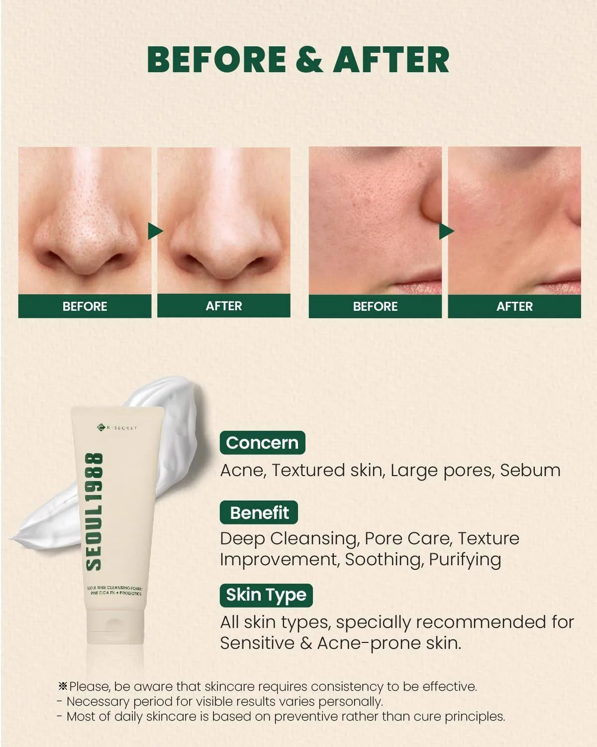 K-Secret - Seoul 1988 Cleansing Foam: Pine Cica 1% + Probiotics