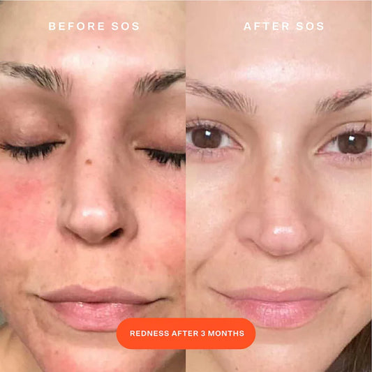 Tower 28 Sos Daily Rescue Facial Spray Mini