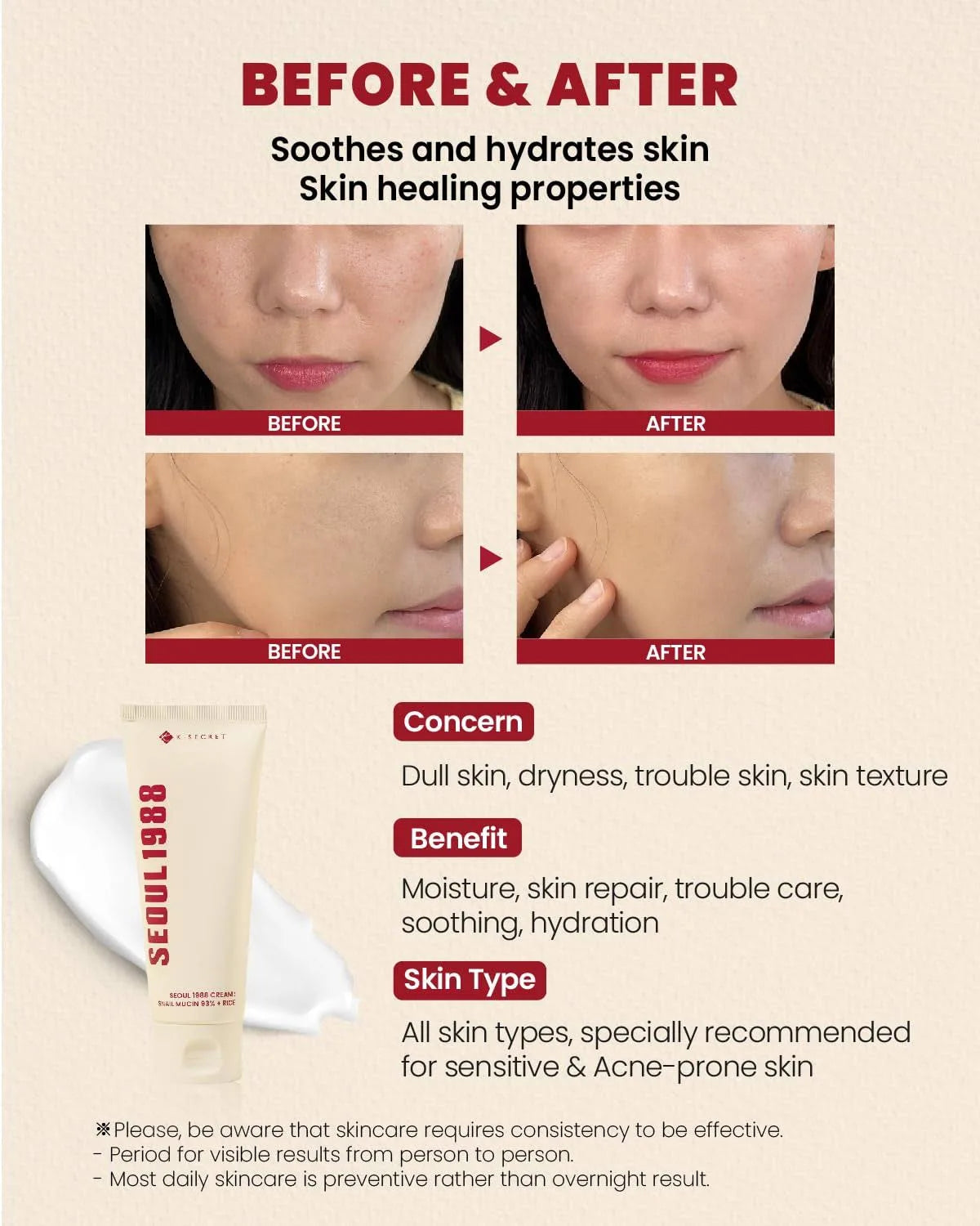 K-Secret - Seoul 1988 Cream: Snail Mucin 93% + Rice
