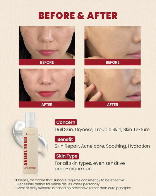 K-Secret - Seoul 1988 Essence: Snail Mucin 97% + Rice