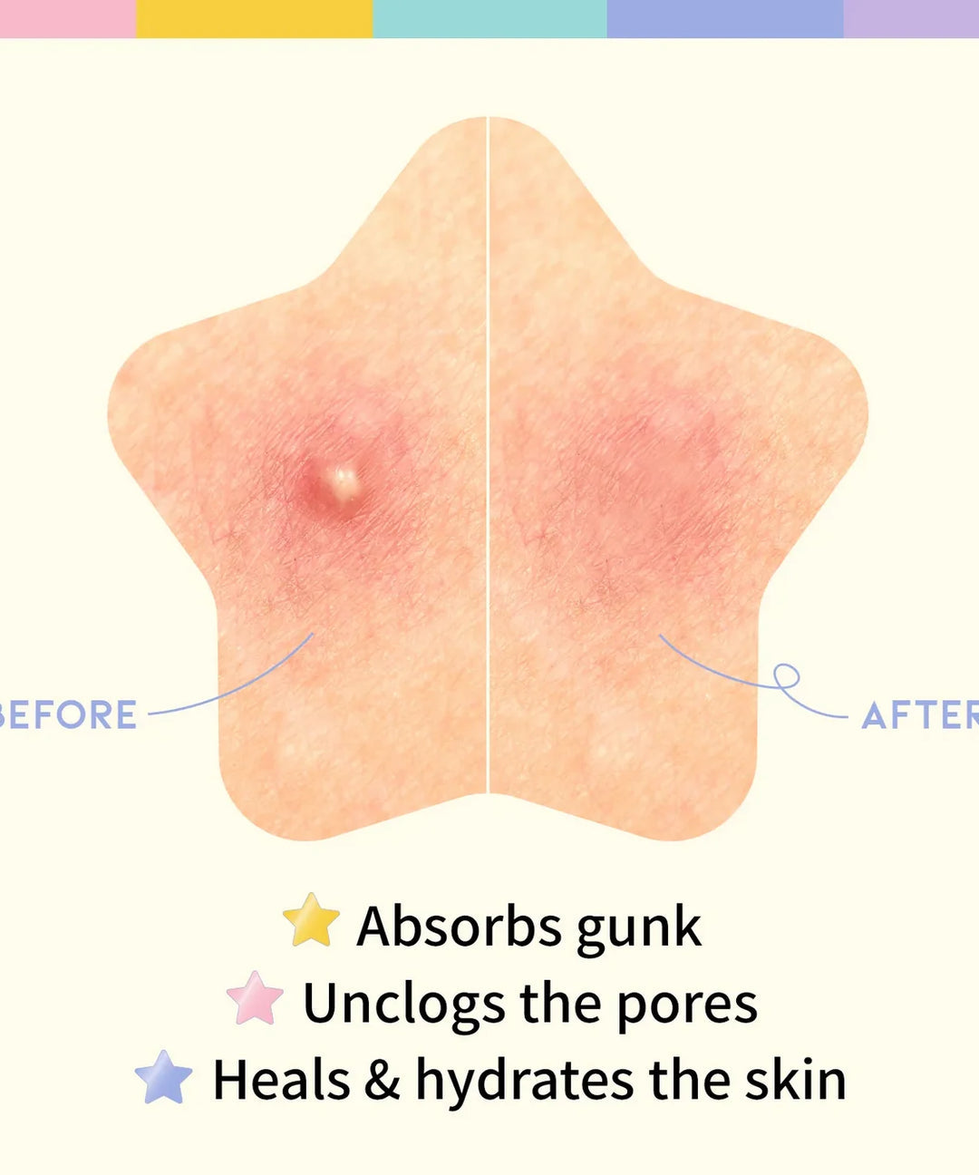 OOTD Star Spot Patch | 80 parches