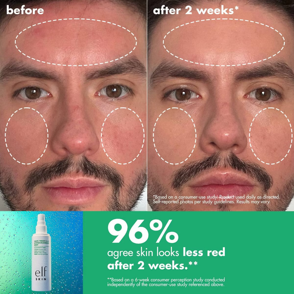 Elf Save Your Skin Hypochlorous Mist